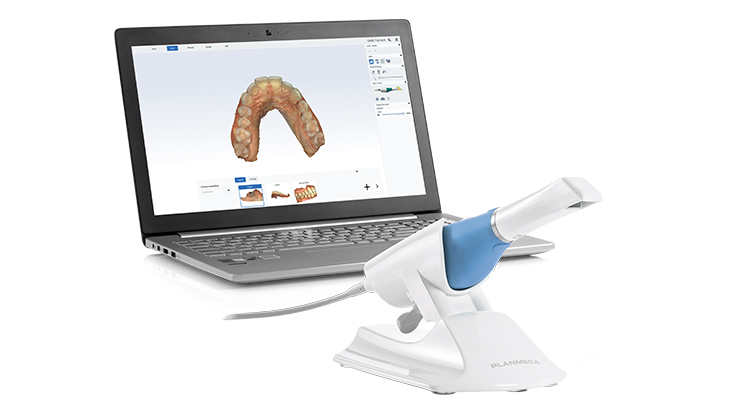 Planmeca Emerald S intraoral scanner with scanned image on laptop screen